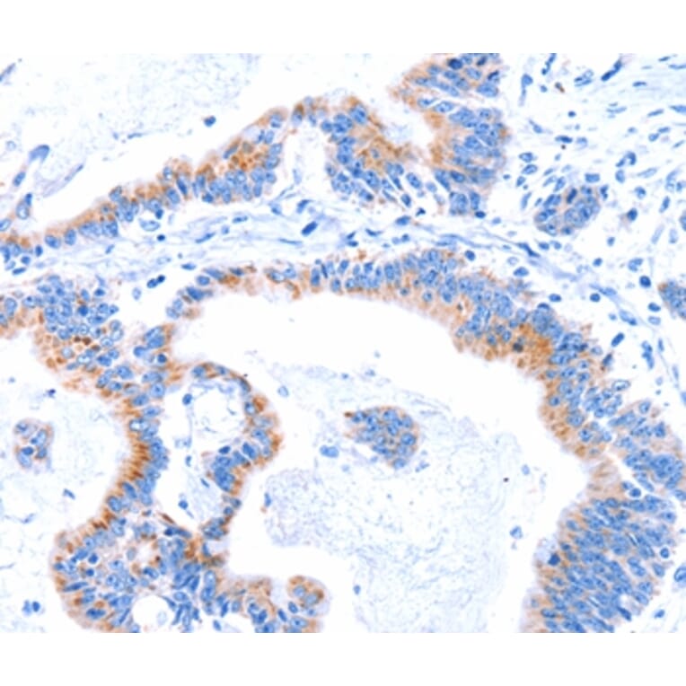 Immunohistochemistry - SMG8 Antibody from Signalway Antibody (37142) - Antibodies.com