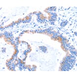 Immunohistochemistry - SMG8 Antibody from Signalway Antibody (37142) - Antibodies.com