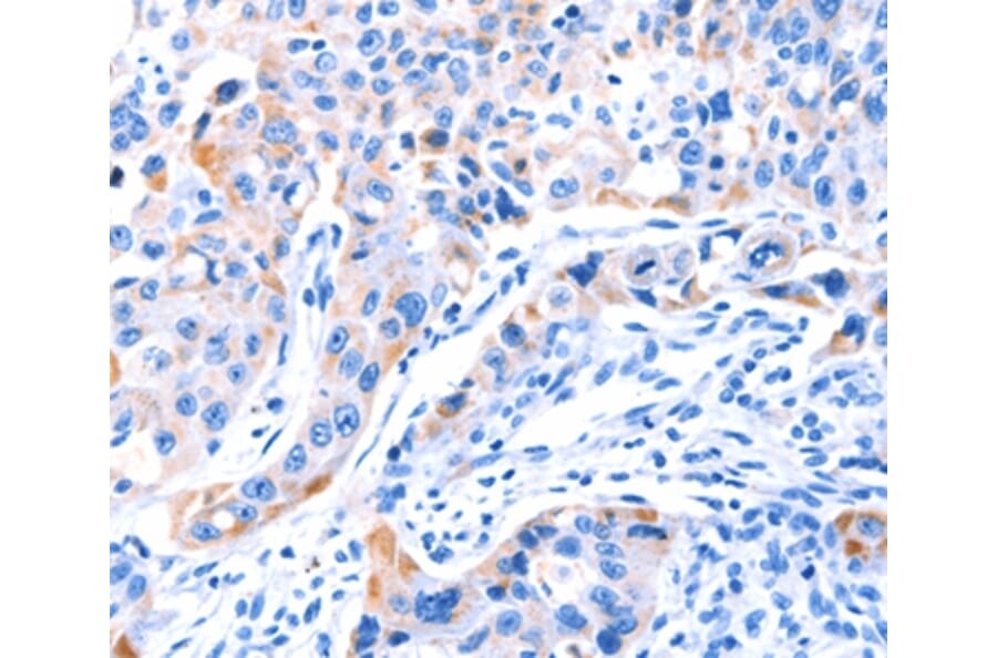 Immunohistochemistry - SMG8 Antibody from Signalway Antibody (37142) - Antibodies.com