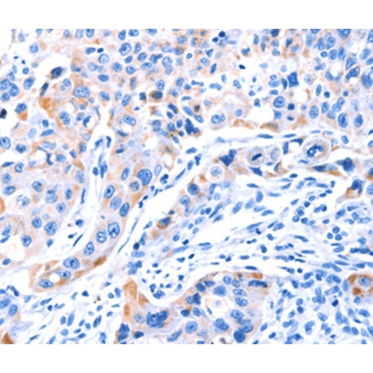 Immunohistochemistry - SMG8 Antibody from Signalway Antibody (37142) - Antibodies.com