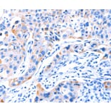 Immunohistochemistry - SMG8 Antibody from Signalway Antibody (37142) - Antibodies.com