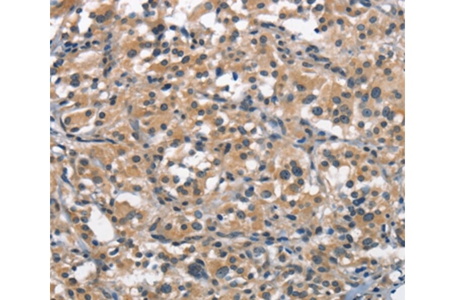 Immunohistochemistry - ACPT Antibody from Signalway Antibody (37143) - Antibodies.com