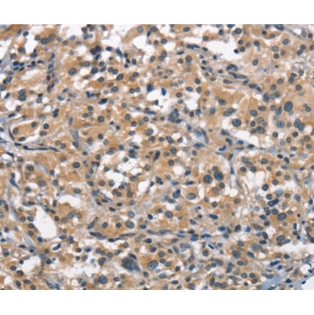 Immunohistochemistry - ACPT Antibody from Signalway Antibody (37143) - Antibodies.com