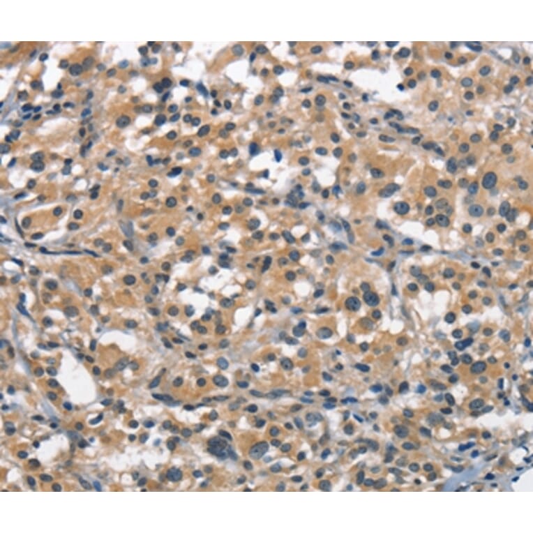 Immunohistochemistry - ACPT Antibody from Signalway Antibody (37143) - Antibodies.com