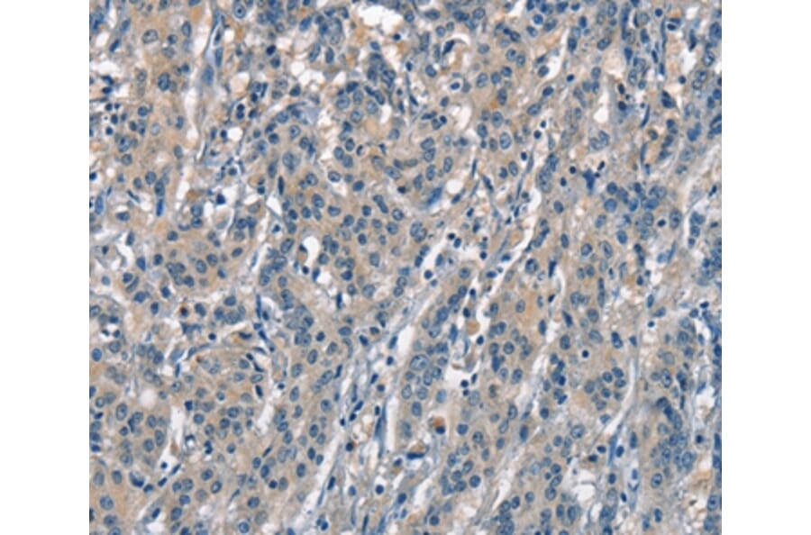 Immunohistochemistry - ACPT Antibody from Signalway Antibody (37143) - Antibodies.com