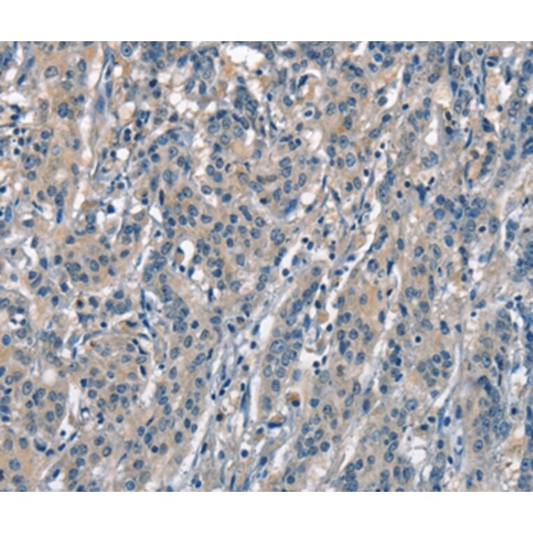 Immunohistochemistry - ACPT Antibody from Signalway Antibody (37143) - Antibodies.com