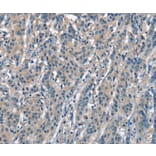 Immunohistochemistry - ACPT Antibody from Signalway Antibody (37143) - Antibodies.com