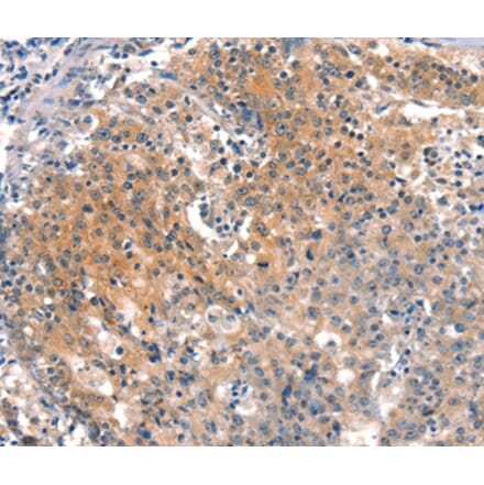 Immunohistochemistry - BFAR Antibody from Signalway Antibody (37153) - Antibodies.com