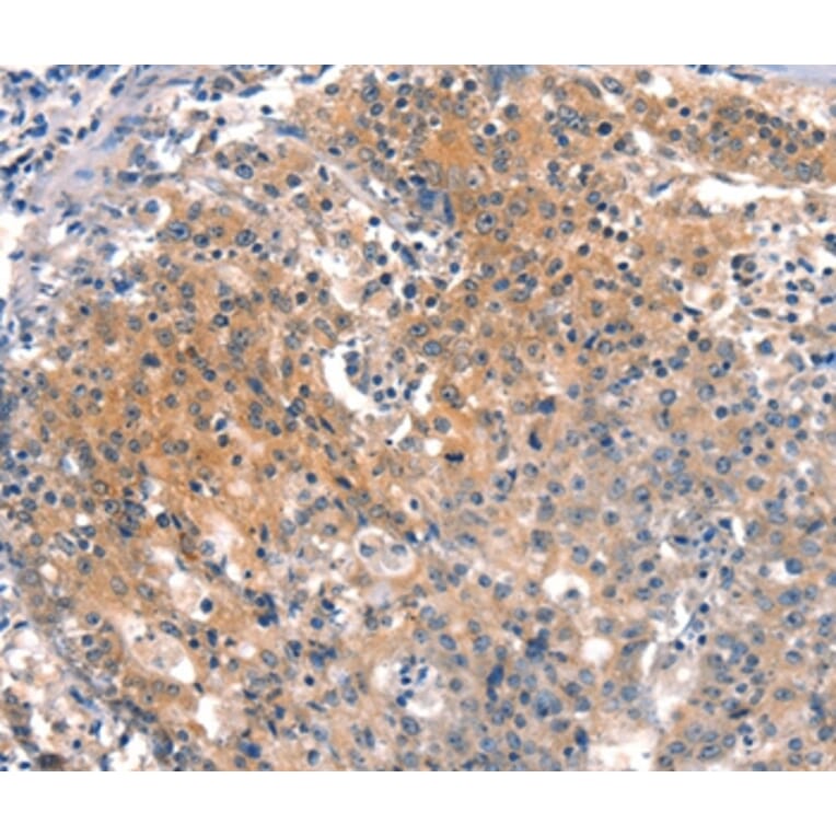 Immunohistochemistry - BFAR Antibody from Signalway Antibody (37153) - Antibodies.com