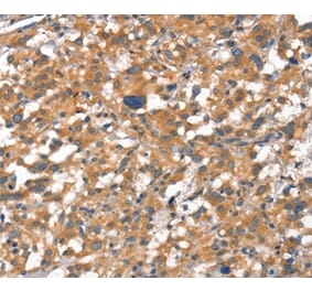 Immunohistochemistry - CDH5 Antibody from Signalway Antibody (37156) - Antibodies.com