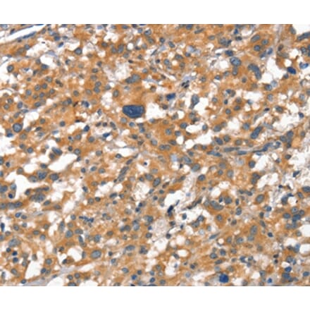 Immunohistochemistry - CDH5 Antibody from Signalway Antibody (37156) - Antibodies.com