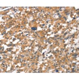 Immunohistochemistry - CDH5 Antibody from Signalway Antibody (37156) - Antibodies.com