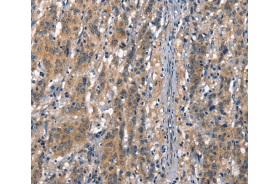 Immunohistochemistry - CDH5 Antibody from Signalway Antibody (37156) - Antibodies.com