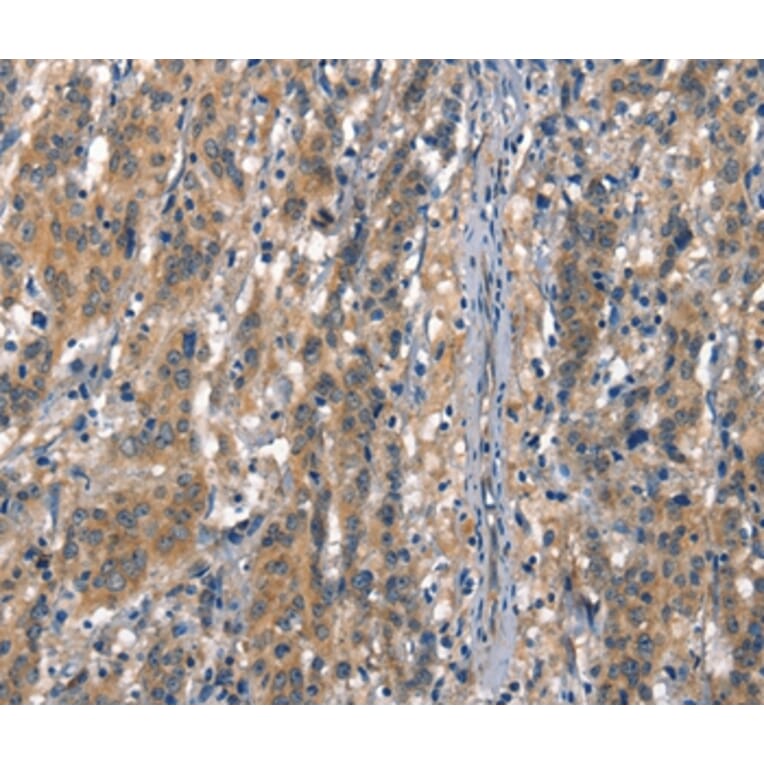 Immunohistochemistry - CDH5 Antibody from Signalway Antibody (37156) - Antibodies.com
