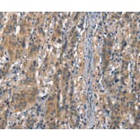Immunohistochemistry - CDH5 Antibody from Signalway Antibody (37156) - Antibodies.com