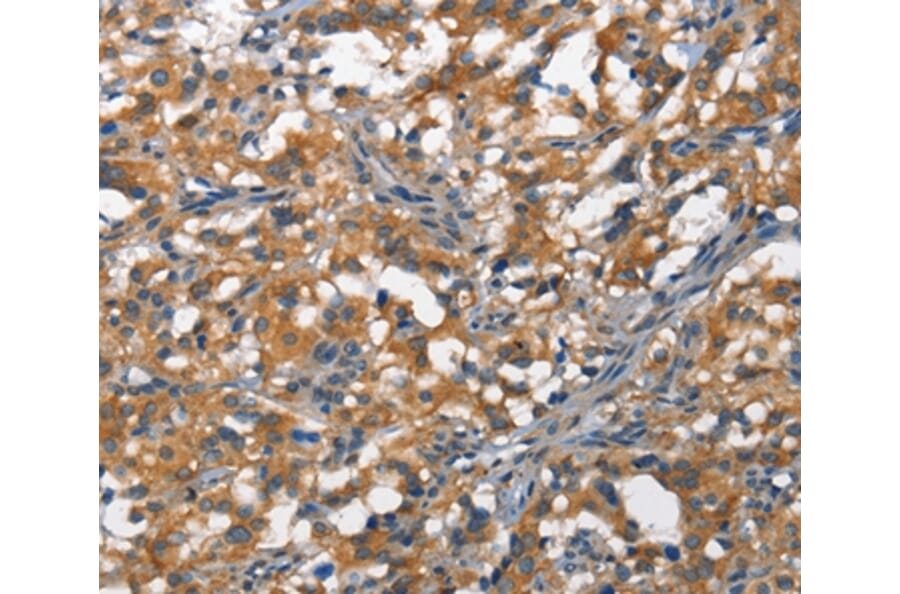 Immunohistochemistry - DDR2 Antibody from Signalway Antibody (37159) - Antibodies.com