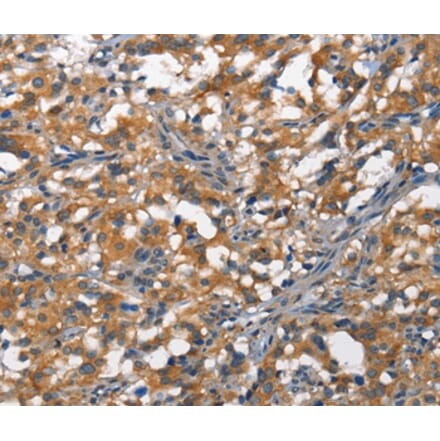 Immunohistochemistry - DDR2 Antibody from Signalway Antibody (37159) - Antibodies.com