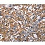 Immunohistochemistry - DDR2 Antibody from Signalway Antibody (37159) - Antibodies.com