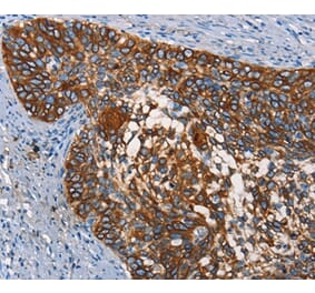 Immunohistochemistry - CD68 Antibody from Signalway Antibody (37164) - Antibodies.com