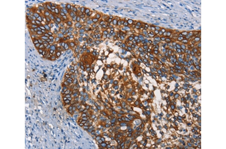 Immunohistochemistry - CD68 Antibody from Signalway Antibody (37164) - Antibodies.com