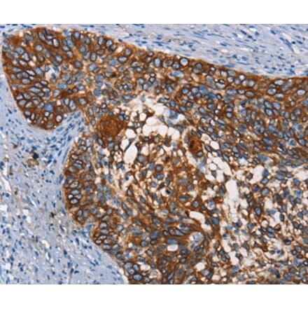 Immunohistochemistry - CD68 Antibody from Signalway Antibody (37164) - Antibodies.com