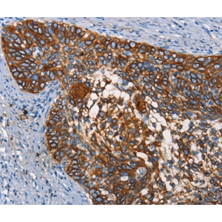 Immunohistochemistry - CD68 Antibody from Signalway Antibody (37164) - Antibodies.com