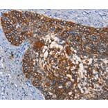 Immunohistochemistry - CD68 Antibody from Signalway Antibody (37164) - Antibodies.com