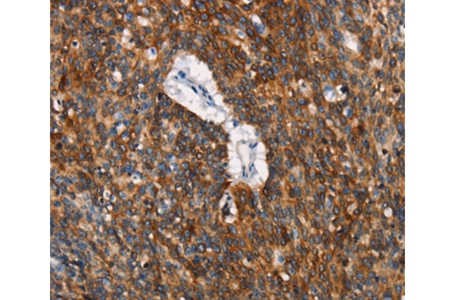 Immunohistochemistry - CD68 Antibody from Signalway Antibody (37164) - Antibodies.com