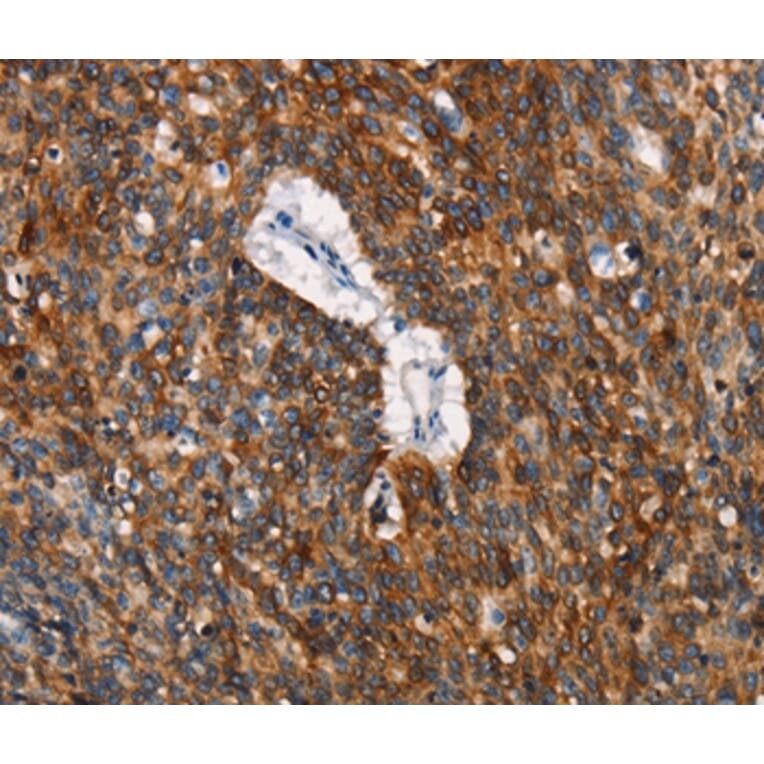 Immunohistochemistry - CD68 Antibody from Signalway Antibody (37164) - Antibodies.com