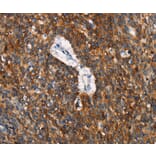 Immunohistochemistry - CD68 Antibody from Signalway Antibody (37164) - Antibodies.com