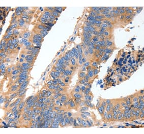 Immunohistochemistry - MUC6 Antibody from Signalway Antibody (37168) - Antibodies.com