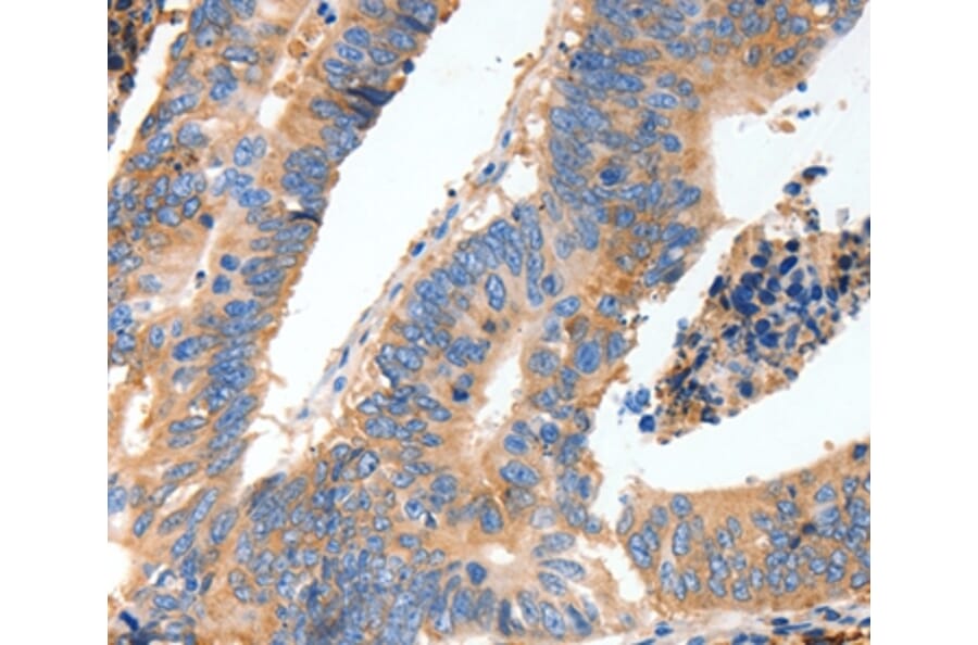 Immunohistochemistry - MUC6 Antibody from Signalway Antibody (37168) - Antibodies.com