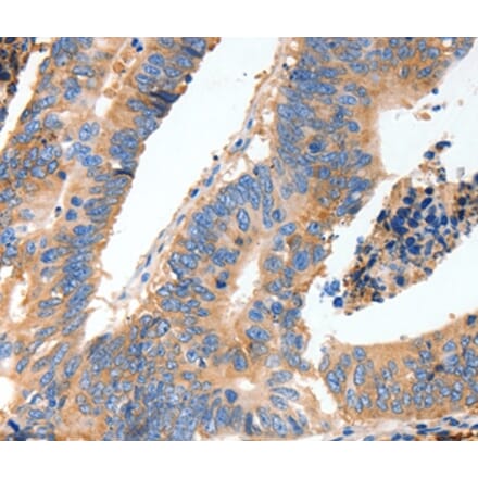 Immunohistochemistry - MUC6 Antibody from Signalway Antibody (37168) - Antibodies.com