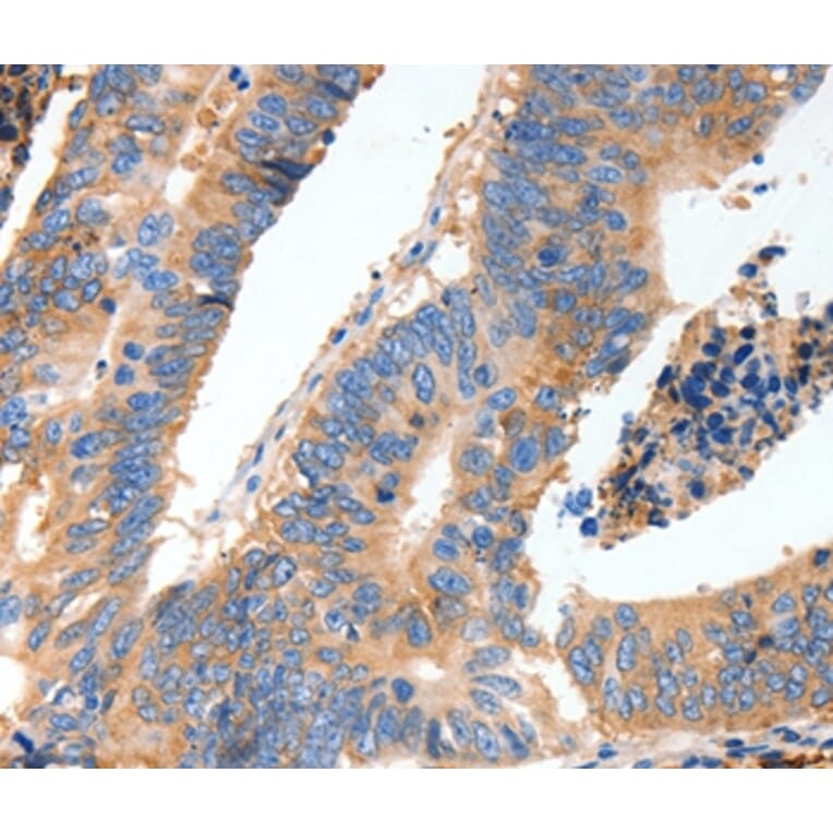 Immunohistochemistry - MUC6 Antibody from Signalway Antibody (37168) - Antibodies.com