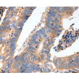 Immunohistochemistry - MUC6 Antibody from Signalway Antibody (37168) - Antibodies.com