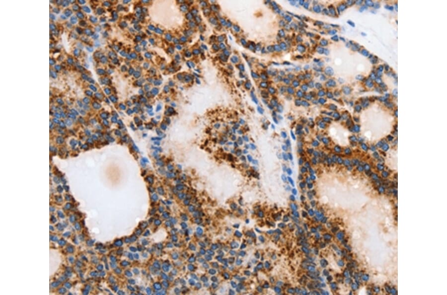 Immunohistochemistry - MUC6 Antibody from Signalway Antibody (37168) - Antibodies.com