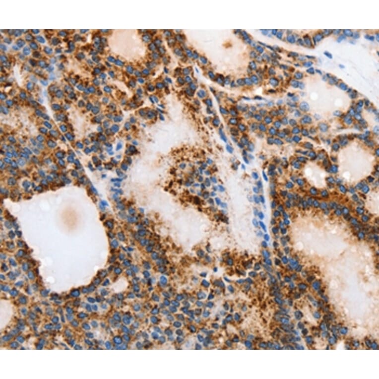 Immunohistochemistry - MUC6 Antibody from Signalway Antibody (37168) - Antibodies.com