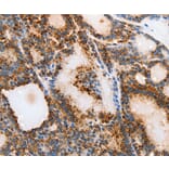Immunohistochemistry - MUC6 Antibody from Signalway Antibody (37168) - Antibodies.com