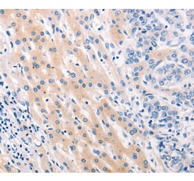 Immunohistochemistry - MUC2 Antibody from Signalway Antibody (37169) - Antibodies.com