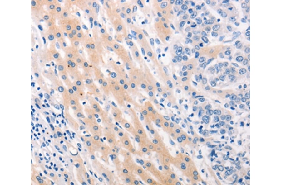 Immunohistochemistry - MUC2 Antibody from Signalway Antibody (37169) - Antibodies.com