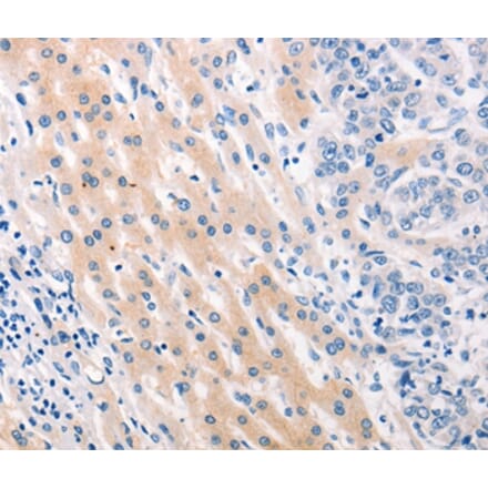 Immunohistochemistry - MUC2 Antibody from Signalway Antibody (37169) - Antibodies.com
