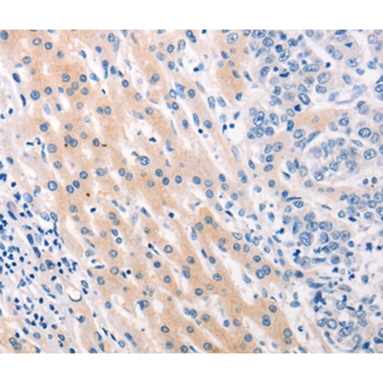 Immunohistochemistry - MUC2 Antibody from Signalway Antibody (37169) - Antibodies.com