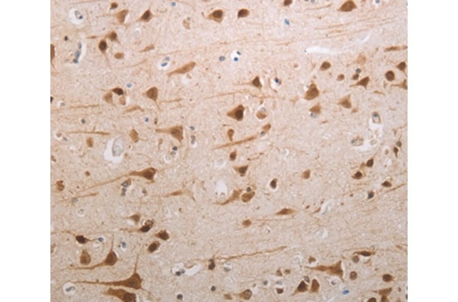Immunohistochemistry - MDC1 Antibody from Signalway Antibody (37181) - Antibodies.com
