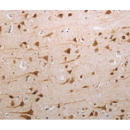 Immunohistochemistry - MDC1 Antibody from Signalway Antibody (37181) - Antibodies.com
