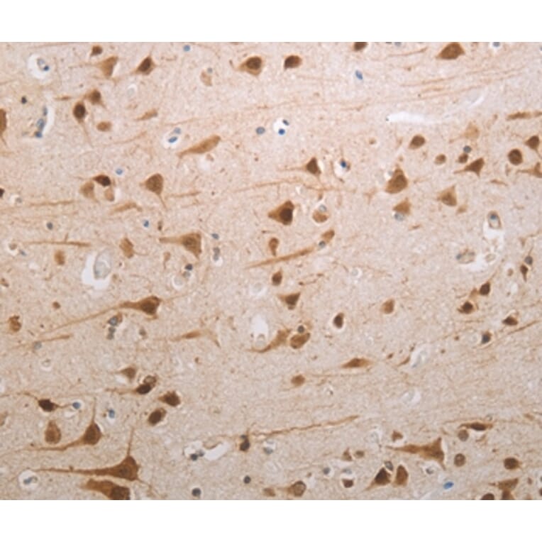 Immunohistochemistry - MDC1 Antibody from Signalway Antibody (37181) - Antibodies.com