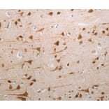 Immunohistochemistry - MDC1 Antibody from Signalway Antibody (37181) - Antibodies.com