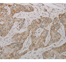 Immunohistochemistry - TAC1 Antibody from Signalway Antibody (37188) - Antibodies.com