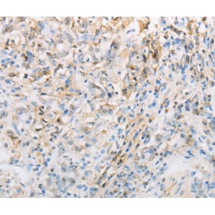 Immunohistochemistry - NPPC Antibody from Signalway Antibody (37196) - Antibodies.com