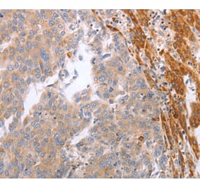 Immunohistochemistry - NRTN Antibody from Signalway Antibody (37199) - Antibodies.com