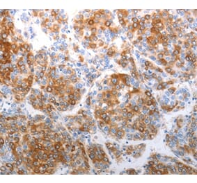 Immunohistochemistry - CHD5 Antibody from Signalway Antibody (37208) - Antibodies.com